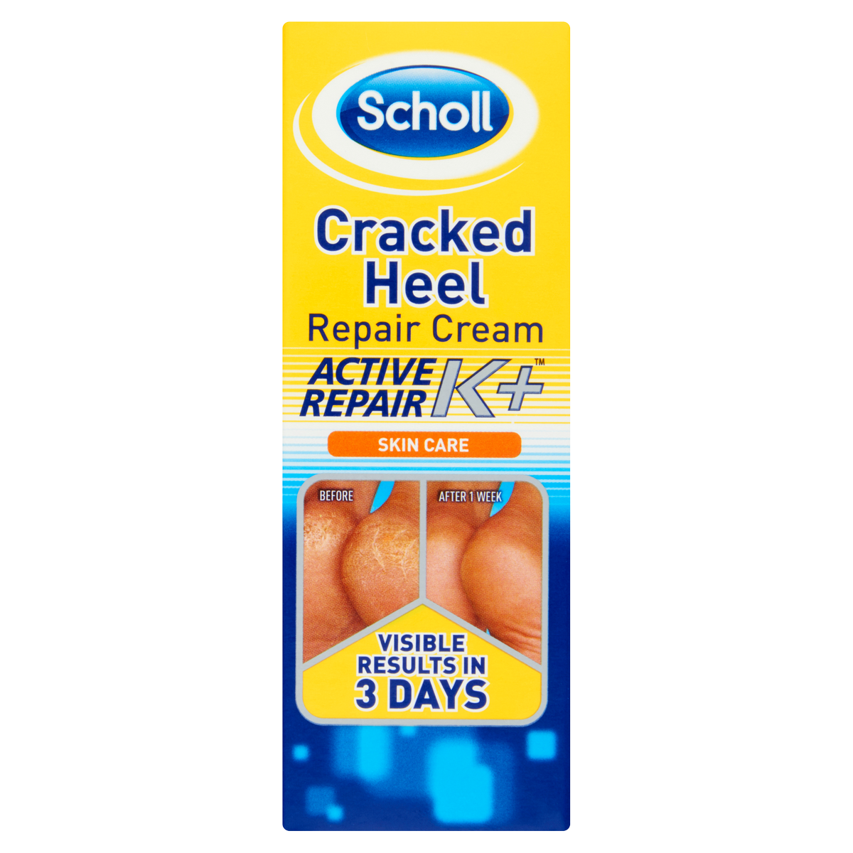 Scholl Balzsam repedt sarokhoz