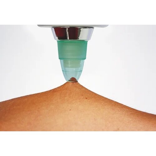 Vakuumni čistilec kože Velform