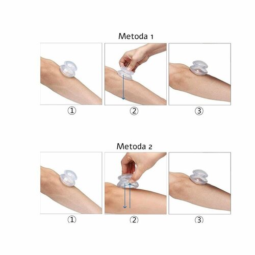 Komplet masažnych banek, 4 ks