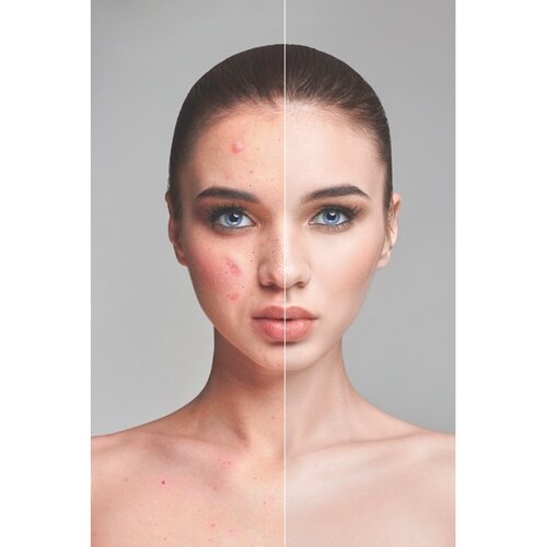 Vakuumni čistilec kože Velform