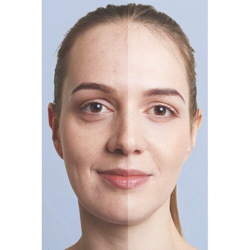 Vakuumni čistilec kože Velform