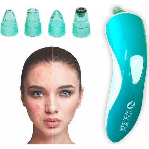 Vakuumni čistilec kože Velform