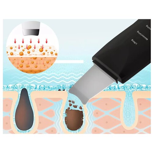 Spatulă cosmetică cu ultrasunete cu atașamenteBlack